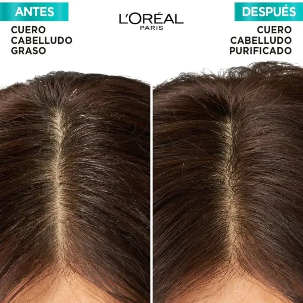 Acondicionador Elvive Hialurónico Pure x 200 ml - Image 5